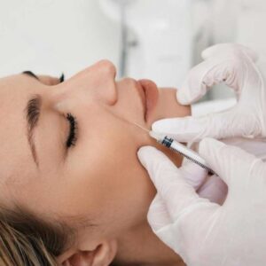 Filler for Smile Lines / Nasolabial Folds