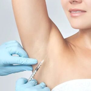 Botox for Underarm Hyperhidrosis