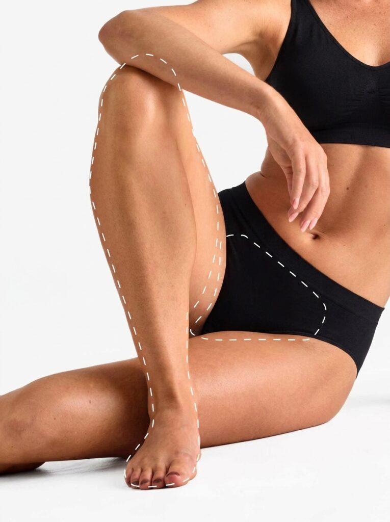 HIFU Vaginal Tightening (Lifting Area)