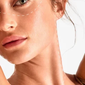 Skin Rejuvenation