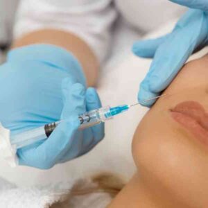 Botox for Downturned Mouth Corners (DAO Muscle)