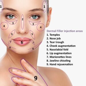 Filler Extra for Any Area 0.5 mL