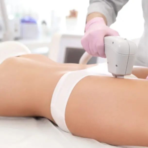 Bikini Laser Hair Removal