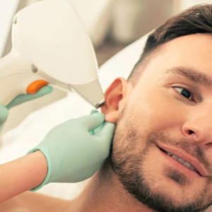 Ear Laser Hair Removal