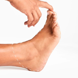 Laser Hair Removal for Each Finger