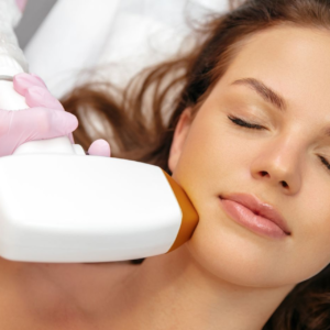 Cheek Laser Hair Removal