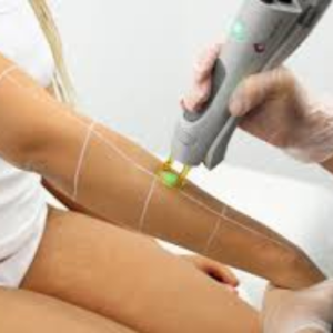 Half Arms Laser Hair Removal