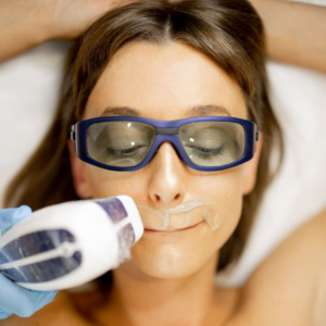 Women's Upper Lip Laser Hair Removal